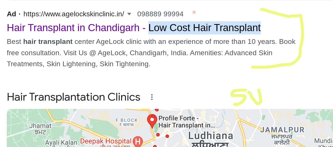 PPC Expert for Hair Transplant in India